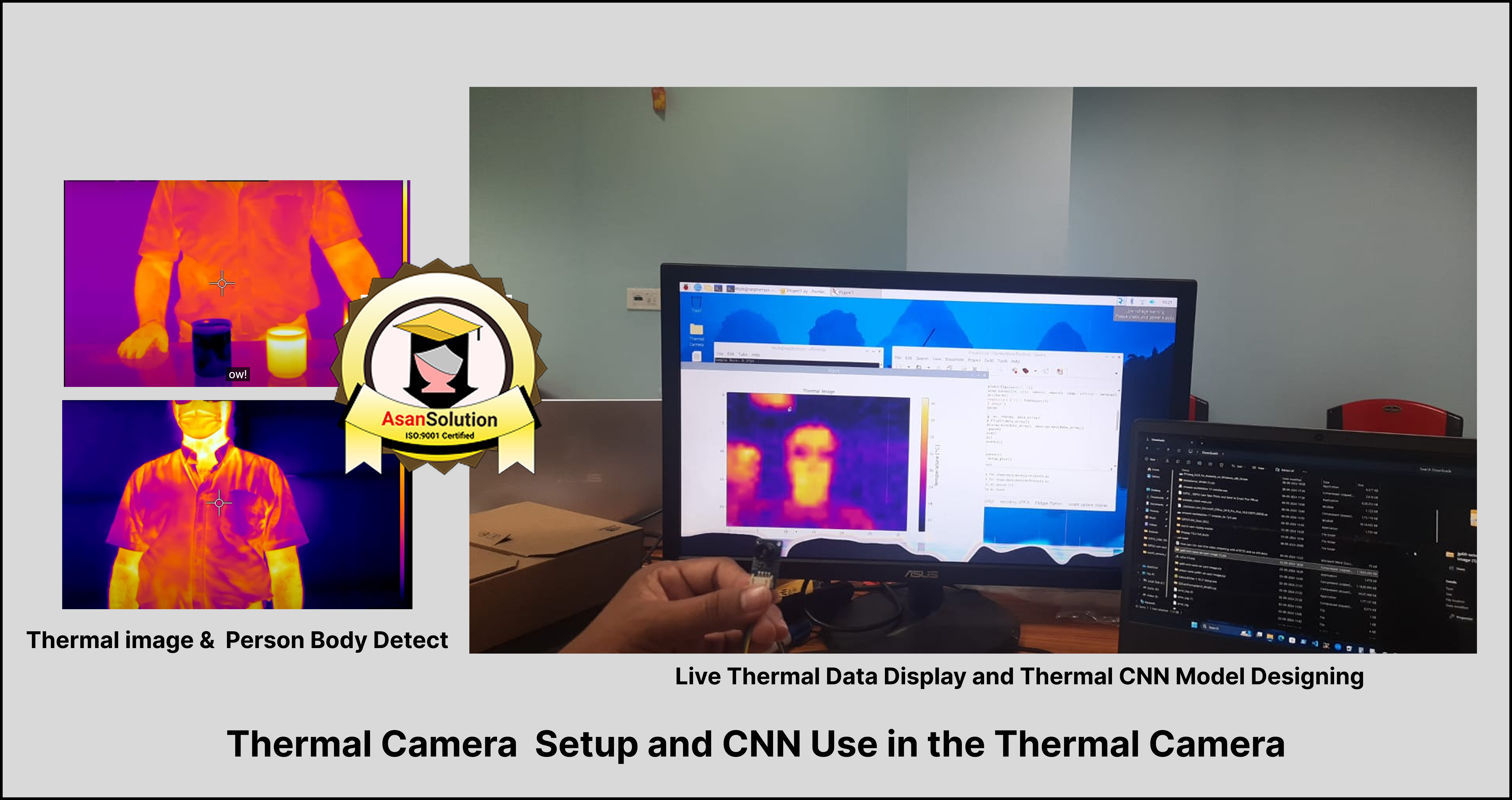 Thermal Pattern Analysis for Human Body Using CNN & Computer Vision